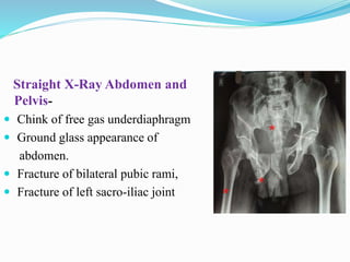 Straight X-Ray Abdomen and
Pelvis-
 Chink of free gas underdiaphragm
 Ground glass appearance of
abdomen.
 Fracture of bilateral pubic rami,
 Fracture of left sacro-iliac joint *
*
*
 