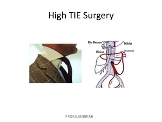 PROF.S.SUBBIAH
High TIE Surgery
 