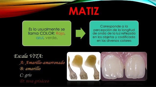 Dientes mas blanco y mas brillo Dientes mas blanco y mas brillo