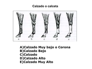 Calzado o calceta Calzado Muy bajo o Corona Calzado Bajo Calzado Calzado Alto Calzado Muy Alto 