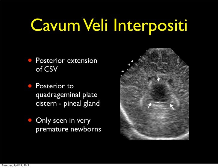 Neonatal Cranial Spinal Sonography
