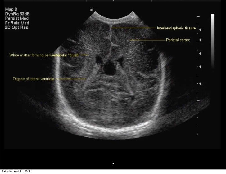Neonatal Cranial Spinal Sonography