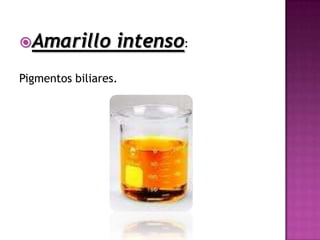 Amarillo         intenso:
Pigmentos biliares.
 