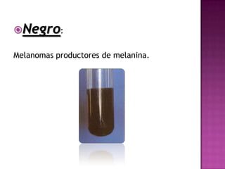 Negro:

Melanomas productores de melanina.
 