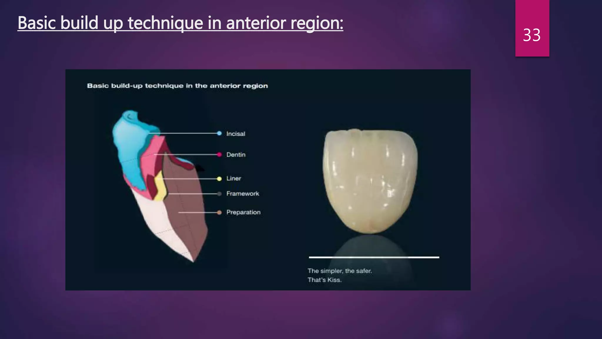 Color science and optics, PROSTHODONTICS | PPTX