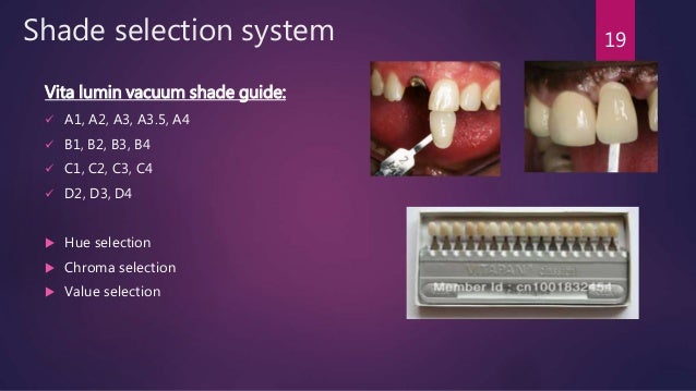 Color science and optics, PROSTHODONTICS