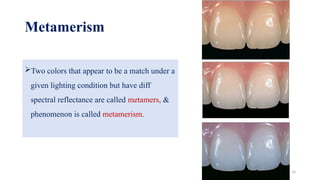 Color Science, Esthetics & Shade Selection In fpd Dr Sonali Talke.pptx