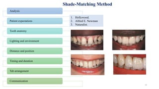 Color Science, Esthetics & Shade Selection In fpd Dr Sonali Talke.pptx