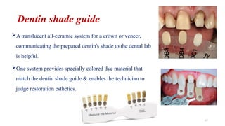 Translucent Shade Tooth Color Science, Esthetics & Shade Selection In fpd Dr Sonali Talke.pptx