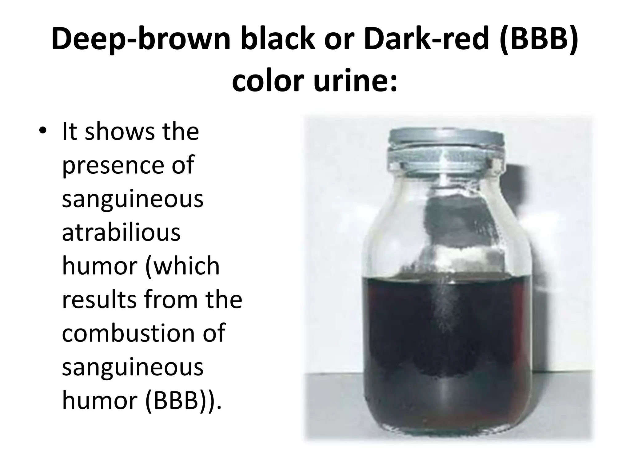 Colors of Urine (Qaroorah) and diagnosis through it. (The Unani Tibbi ...