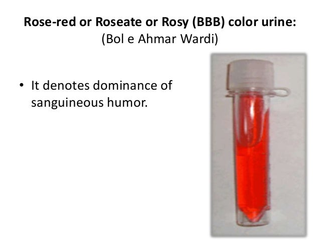 Colors of Urine (Qaroorah) and diagnosis through it. (The Unani Tibbi…