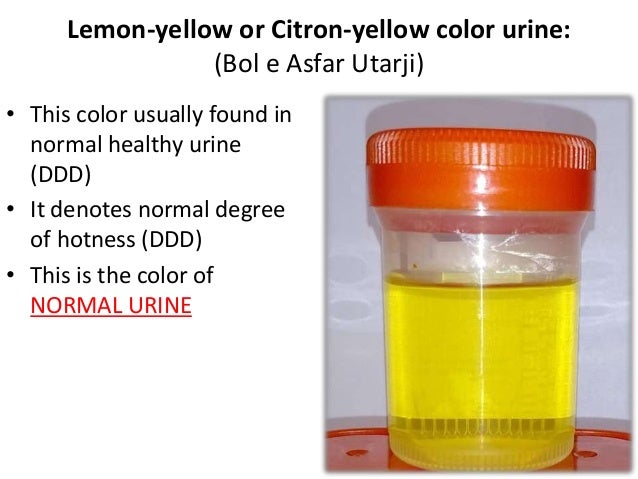 Colors Of Urine Qaroorah And Diagnosis Through It The Effy Moom Free Coloring Picture wallpaper give a chance to color on the wall without getting in trouble! Fill the walls of your home or office with stress-relieving [effymoom.blogspot.com]