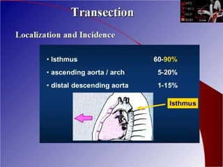 Endovascular repair of traumatic aortic transection | PPT