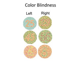 Left Color Right Color Color vision | PPT