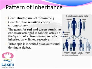 Pattern of inheritance
 Gene rhodopsin - chromosome 3.
 Gene for blue sensitive cone -
chromosome 7
 The genes for red and green sensitive
cones are arranged in tandem array on
the ‘q’ arm of x chromosome so defect is
inherited as x- linked recessive
 Tritanopia is inherited as an autosomal
dominant defect,
 