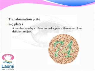  Transformation plate
 2-9 plates
 A number seen by a colour normal appear different to colour
deficient subject.
 