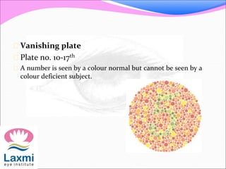  Vanishing plate
 Plate no. 10-17th
 A number is seen by a colour normal but cannot be seen by a
colour deficient subject.
 