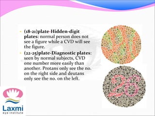 • (18-21)plate-Hidden-digit
plates: normal person does not
see a figure while a CVD will see
the figure.
• (22-25)plate-Diagnostic plates:
seen by normal subjects, CVD
one number more easily than
another. Protans only see the no.
on the right side and deutans
only see the no. on the left.
 