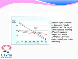 Graphic representation
of diagnostic results
obtained with the nagel
anomaloscope showing
different matching
ranges and yellow
luminance values in
protan and deutan colour
deficiency
 