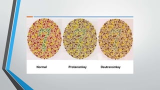 Color vision - concepts | PPTX