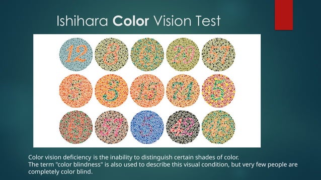 Color Vision..pptx mesicine surgey clinical | PPTX