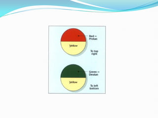 Color Vision, its assesment and management | PDF