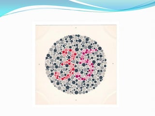 Color Vision, its assesment and management | PDF