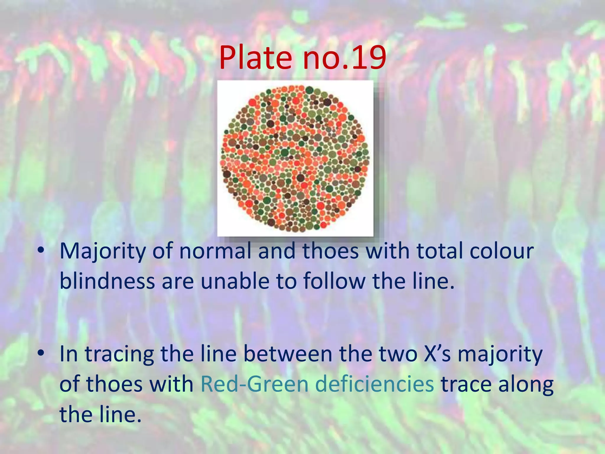 Color Vision Deficiency and Ishihara's Test | PPSX