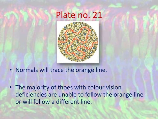 Color Vision Deficiency and Ishihara's Test | PPSX