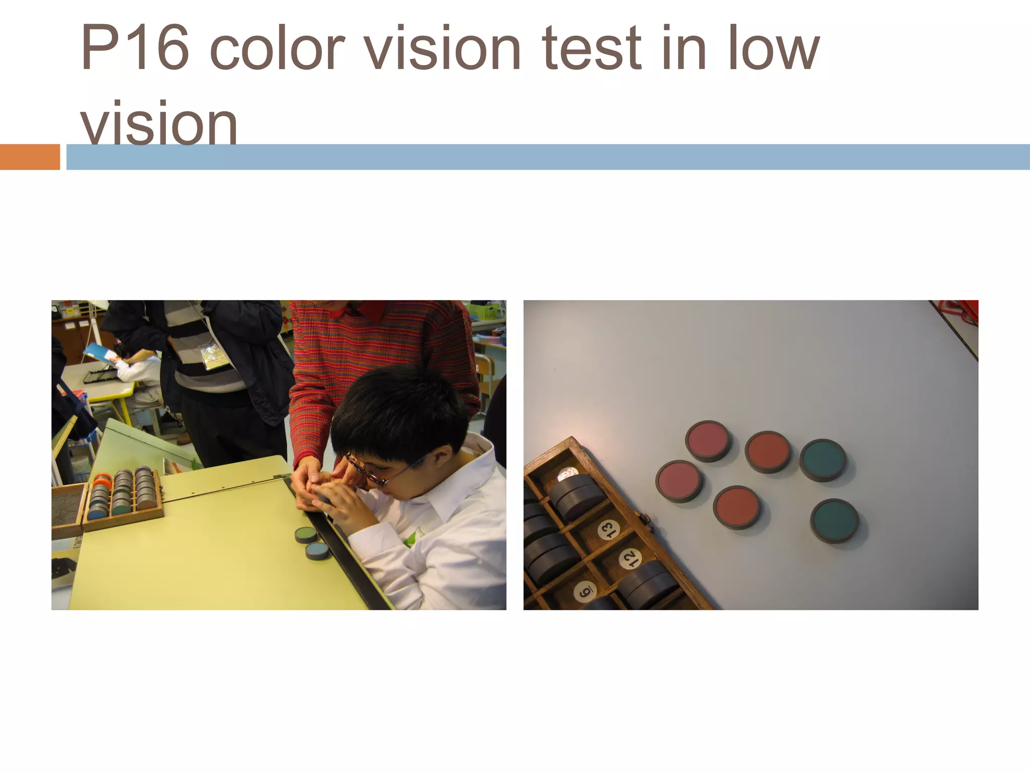 P16 color vision test in low
vision
 