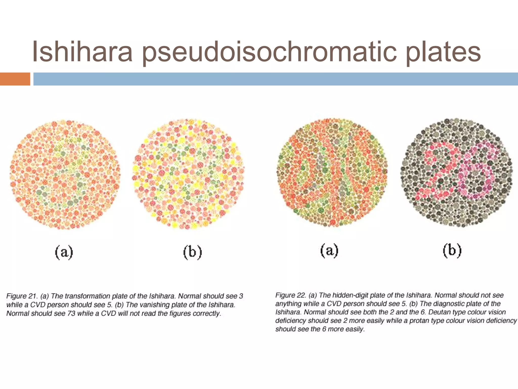 Ishihara pseudoisochromatic plates
 