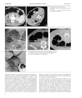 Coloscopie virtuelle par scanner | PDF