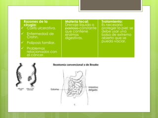 Razones de la
cirugía:
 Colitis ulcerativa.
 Enfermedad de
Crohn.
 Poliposis familiar.
 Problemas
relacionados con
el cáncer.
Materia fecal:
Drenaje líquido o
pastoso constante
que contiene
enzimas
digestivas.
Tratamiento:
Es necesario
proteger la piel; se
debe usar una
bolsa de extremo
abierto que se
pueda vaciar.
 