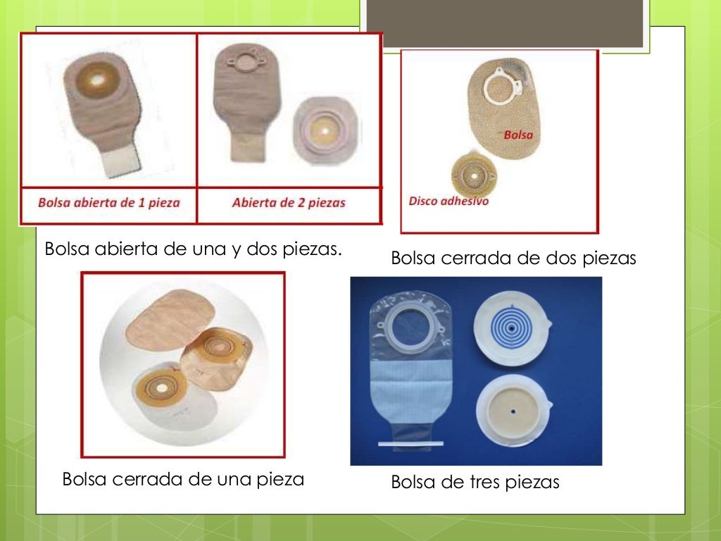colostomia e ileostomia colostomia e ileostomia