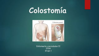 Colostomía 
Enfermería y sociedades II 
0704 
Grupo 1 
 