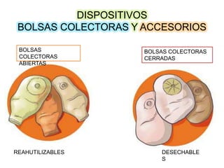 DISPOSITIVOS
BOLSAS COLECTORAS Y ACCESORIOS
BOLSAS
COLECTORAS
ABIERTAS

REAHUTILIZABLES

BOLSAS COLECTORAS
CERRADAS

DESECHABLE
S

 