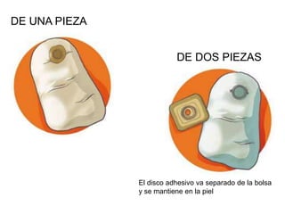 DE UNA PIEZA
DE DOS PIEZAS

El disco adhesivo va separado de la bolsa
y se mantiene en la piel

 