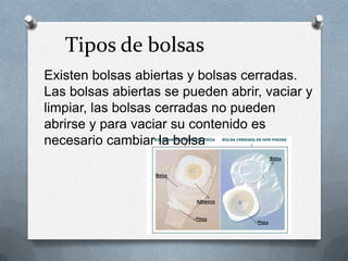Tipos de bolsas
Existen bolsas abiertas y bolsas cerradas.
Las bolsas abiertas se pueden abrir, vaciar y
limpiar, las bolsas cerradas no pueden
abrirse y para vaciar su contenido es
necesario cambiar la bolsa
 