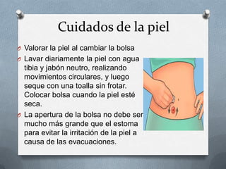 Cuidados de la piel
O Valorar la piel al cambiar la bolsa
O Lavar diariamente la piel con agua
tibia y jabón neutro, realizando
movimientos circulares, y luego
seque con una toalla sin frotar.
Colocar bolsa cuando la piel esté
seca.
O La apertura de la bolsa no debe ser
mucho más grande que el estoma
para evitar la irritación de la piel a
causa de las evacuaciones.
 