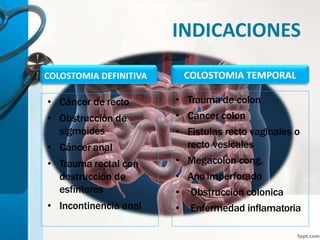 INDICACIONES
COLOSTOMIA DEFINITIVA
• Cáncer de recto
• Obstrucción de
sigmoides
• Cáncer anal
• Trauma rectal con
destrucción de
esfínteres
• Incontinencia anal
• Trauma de colon
• Cáncer colon
• Fistulas recto vaginales o
recto vesicales
• Megacolon cong.
• Ano imperforado
• Obstrucción colonica
• Enfermedad inflamatoria
COLOSTOMIA TEMPORAL
 