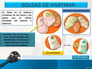BOLSAS DE HARTMAN
La bolsa es un sistema
recolector de las heces y los
gases que se coloca
alrededor del estoma o
abertura.
Cerradas o de un solo uso:
son recomendables para
colostomías transversas o
descendentes ya que las
heces son más sólidas.
Abiertas o de varios usos
De una pieza
De dos piezas
 