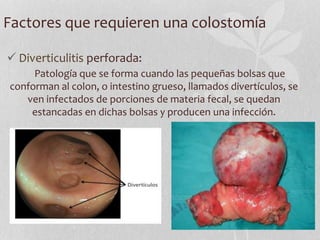 Factores que requieren una colostomía
 Diverticulitis perforada:
Patología que se forma cuando las pequeñas bolsas que
conforman al colon, o intestino grueso, llamados divertículos, se
ven infectados de porciones de materia fecal, se quedan
estancadas en dichas bolsas y producen una infección.
 