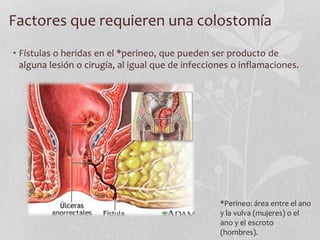 • Fístulas o heridas en el *perineo, que pueden ser producto de
alguna lesión o cirugía, al igual que de infecciones o inflamaciones.
Factores que requieren una colostomía
*Perineo: área entre el ano
y la vulva (mujeres) o el
ano y el escroto
(hombres).
 