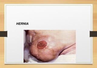 - HERNIA.
 