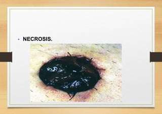  NECROSIS.
 