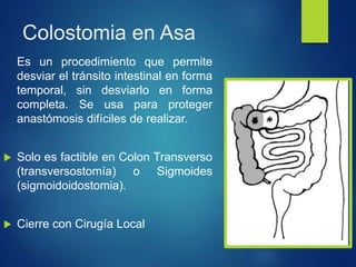 Colostomia en Asa
Es un procedimiento que permite
desviar el tránsito intestinal en forma
temporal, sin desviarlo en forma
completa. Se usa para proteger
anastómosis difíciles de realizar.
 Solo es factible en Colon Transverso
(transversostomía) o Sigmoides
(sigmoidoidostomia).
 Cierre con Cirugía Local
 