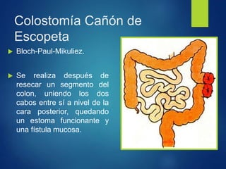 Colostomía Cañón de
Escopeta
 Bloch-Paul-Mikuliez.
 Se realiza después de
resecar un segmento del
colon, uniendo los dos
cabos entre sí a nivel de la
cara posterior, quedando
un estoma funcionante y
una fístula mucosa.
 