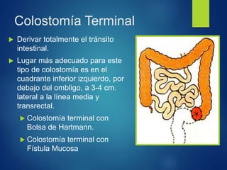 Colostomía Terminal
 Derivar totalmente el tránsito
intestinal.
 Lugar más adecuado para este
tipo de colostomía es en el
cuadrante inferior izquierdo, por
debajo del ombligo, a 3-4 cm.
lateral a la línea media y
transrectal.
 Colostomía terminal con
Bolsa de Hartmann.
 Colostomía terminal con
Fístula Mucosa
 