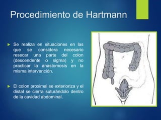 Procedimiento de Hartmann
 Se realiza en situaciones en las
que se considera necesario
resecar una parte del colon
(descendente o sigma) y no
practicar la anastomosis en la
misma intervención.
 El colon proximal se exterioriza y el
distal se cierra suturándolo dentro
de la cavidad abdominal.
 