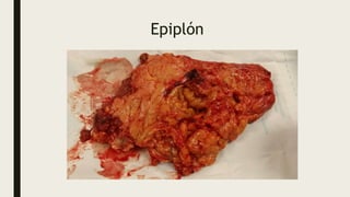 Epiplón
 